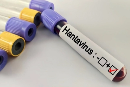 Hantavir&uuml;s salgına d&ouml;n&uuml;ş&uuml;r m&uuml;? Kapalı alan temizliğinde b&uuml;y&uuml;k risk