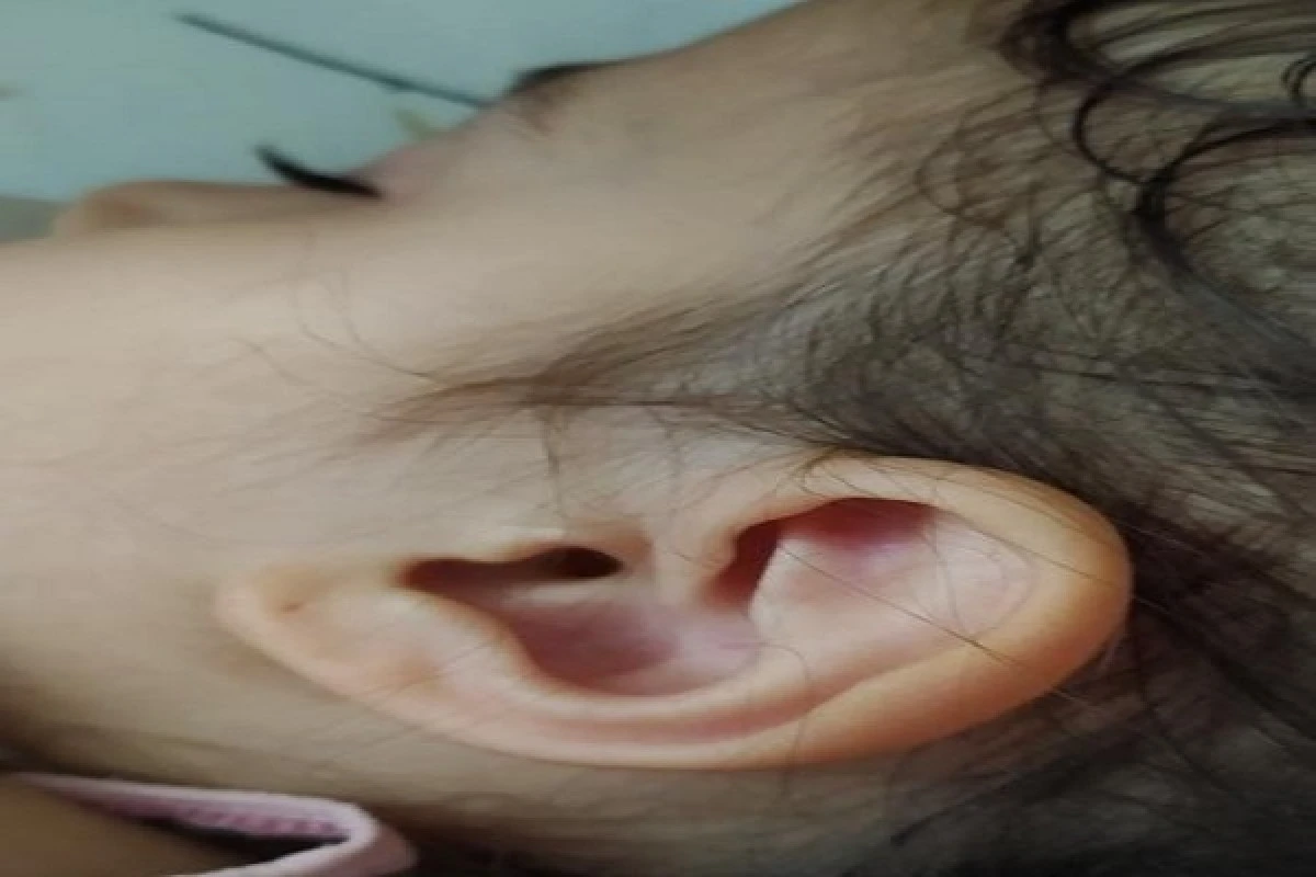 Parkta 3 yaşındaki çocuğun kulağına kene yapıştı